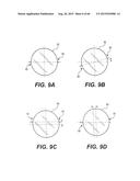 MODULAR INTRAOCULAR LENS DESIGNS, TOOLS AND METHODS diagram and image