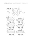 MODULAR INTRAOCULAR LENS DESIGNS, TOOLS AND METHODS diagram and image