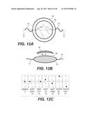 MODULAR INTRAOCULAR LENS DESIGNS, TOOLS AND METHODS diagram and image