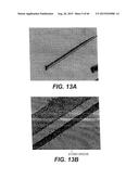 MODULAR INTRAOCULAR LENS DESIGNS, TOOLS AND METHODS diagram and image