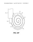 MODULAR INTRAOCULAR LENS DESIGNS, TOOLS AND METHODS diagram and image