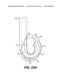 MODULAR INTRAOCULAR LENS DESIGNS, TOOLS AND METHODS diagram and image