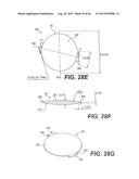 MODULAR INTRAOCULAR LENS DESIGNS, TOOLS AND METHODS diagram and image