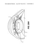 MODULAR INTRAOCULAR LENS DESIGNS, TOOLS AND METHODS diagram and image