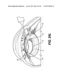 MODULAR INTRAOCULAR LENS DESIGNS, TOOLS AND METHODS diagram and image