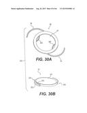 MODULAR INTRAOCULAR LENS DESIGNS, TOOLS AND METHODS diagram and image