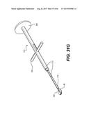 MODULAR INTRAOCULAR LENS DESIGNS, TOOLS AND METHODS diagram and image