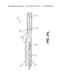 MODULAR INTRAOCULAR LENS DESIGNS, TOOLS AND METHODS diagram and image