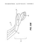 MODULAR INTRAOCULAR LENS DESIGNS, TOOLS AND METHODS diagram and image