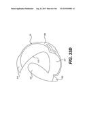 MODULAR INTRAOCULAR LENS DESIGNS, TOOLS AND METHODS diagram and image