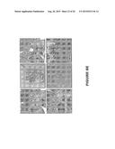 MDM2 INHIBITORS FOR TREATMENT OF OCULAR CONDITIONS diagram and image