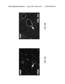 REGENERATION AND REPAIR OF NEURAL TISSUE FOLLOWING INJURY diagram and image