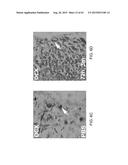 REGENERATION AND REPAIR OF NEURAL TISSUE FOLLOWING INJURY diagram and image