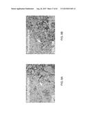 REGENERATION AND REPAIR OF NEURAL TISSUE FOLLOWING INJURY diagram and image