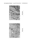 REGENERATION AND REPAIR OF NEURAL TISSUE FOLLOWING INJURY diagram and image