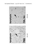 REGENERATION AND REPAIR OF NEURAL TISSUE FOLLOWING INJURY diagram and image