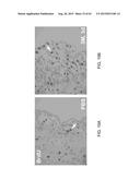 REGENERATION AND REPAIR OF NEURAL TISSUE FOLLOWING INJURY diagram and image