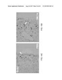 REGENERATION AND REPAIR OF NEURAL TISSUE FOLLOWING INJURY diagram and image