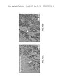 REGENERATION AND REPAIR OF NEURAL TISSUE FOLLOWING INJURY diagram and image