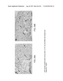 REGENERATION AND REPAIR OF NEURAL TISSUE FOLLOWING INJURY diagram and image