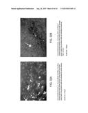REGENERATION AND REPAIR OF NEURAL TISSUE FOLLOWING INJURY diagram and image