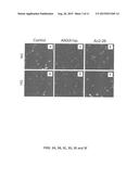 COMPOSITIONS AND METHODS FOR THE TREATMENT OF MYOCARDIAL     ISCHEMIA/REPERFUSION INJURY WITH ANNEXIN A1 SHORT PEPTIDE diagram and image