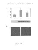 COMPOSITIONS AND METHODS FOR THE TREATMENT OF MYOCARDIAL     ISCHEMIA/REPERFUSION INJURY WITH ANNEXIN A1 SHORT PEPTIDE diagram and image
