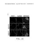 COMPOSITIONS AND METHODS FOR TREATING AMYOTROPHIC LATERAL SCLEROSIS diagram and image