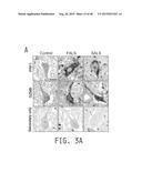 COMPOSITIONS AND METHODS FOR TREATING AMYOTROPHIC LATERAL SCLEROSIS diagram and image