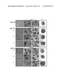 ISOLATION AND CO-TRANSPLANTAION OF BONE MARROW MESENCHYMAL STEM CELLS WITH     CD34+ HEMATOPOIETIC STEM/PROGENITOR CELLS diagram and image