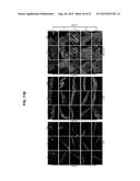 ISOLATION AND CO-TRANSPLANTAION OF BONE MARROW MESENCHYMAL STEM CELLS WITH     CD34+ HEMATOPOIETIC STEM/PROGENITOR CELLS diagram and image