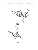 APPARATUS FOR DELIVERING FLUID TO TREAT RENAL HYPERTENSION diagram and image