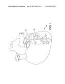 ENDOVASCULAR DEVICES AND METHODS FOR EXPLOITING INTRAMURAL SPACE diagram and image