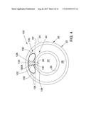 ENDOVASCULAR DEVICES AND METHODS FOR EXPLOITING INTRAMURAL SPACE diagram and image