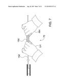 ENDOVASCULAR DEVICES AND METHODS FOR EXPLOITING INTRAMURAL SPACE diagram and image