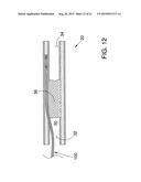 ENDOVASCULAR DEVICES AND METHODS FOR EXPLOITING INTRAMURAL SPACE diagram and image