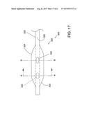 ENDOVASCULAR DEVICES AND METHODS FOR EXPLOITING INTRAMURAL SPACE diagram and image