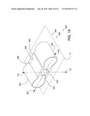 ENDOVASCULAR DEVICES AND METHODS FOR EXPLOITING INTRAMURAL SPACE diagram and image