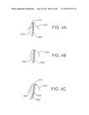 INTRAVASCULAR CATHETERS, SYSTEMS, AND METHODS diagram and image