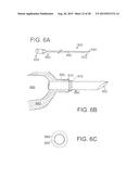 INTRAVASCULAR CATHETERS, SYSTEMS, AND METHODS diagram and image