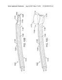 INTRAVASCULAR CATHETERS, SYSTEMS, AND METHODS diagram and image