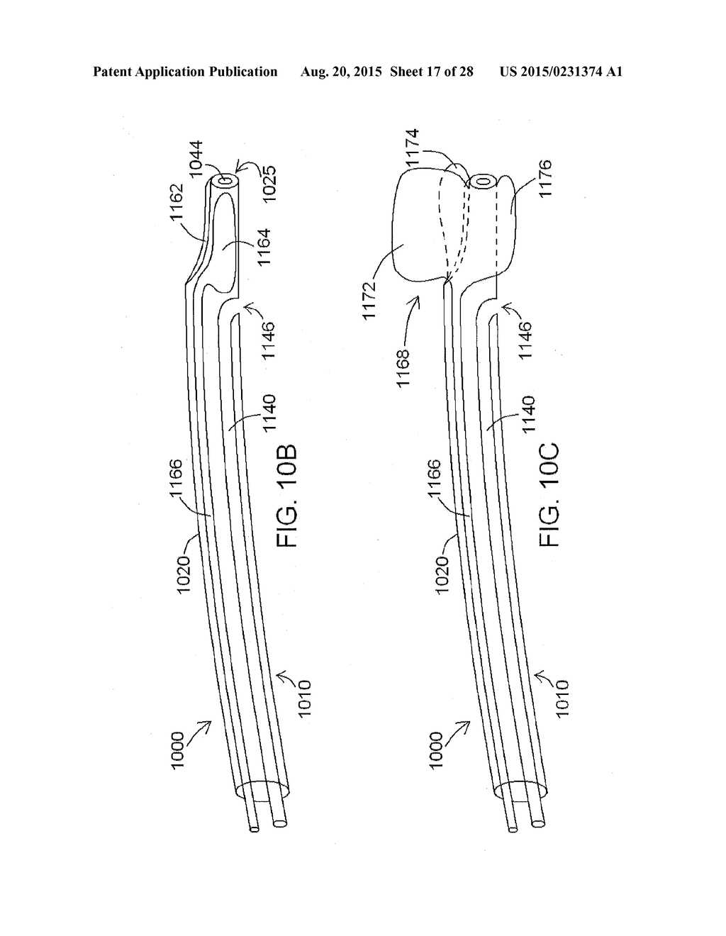 INTRAVASCULAR CATHETERS, SYSTEMS, AND METHODS - diagram, schematic, and image 18