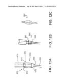 INTRAVASCULAR CATHETERS, SYSTEMS, AND METHODS diagram and image