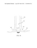 INTRAVASCULAR CATHETERS, SYSTEMS, AND METHODS diagram and image