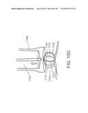 INTRAVASCULAR CATHETERS, SYSTEMS, AND METHODS diagram and image