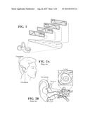 COCHLEAR IMPLANT diagram and image