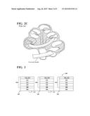 COCHLEAR IMPLANT diagram and image