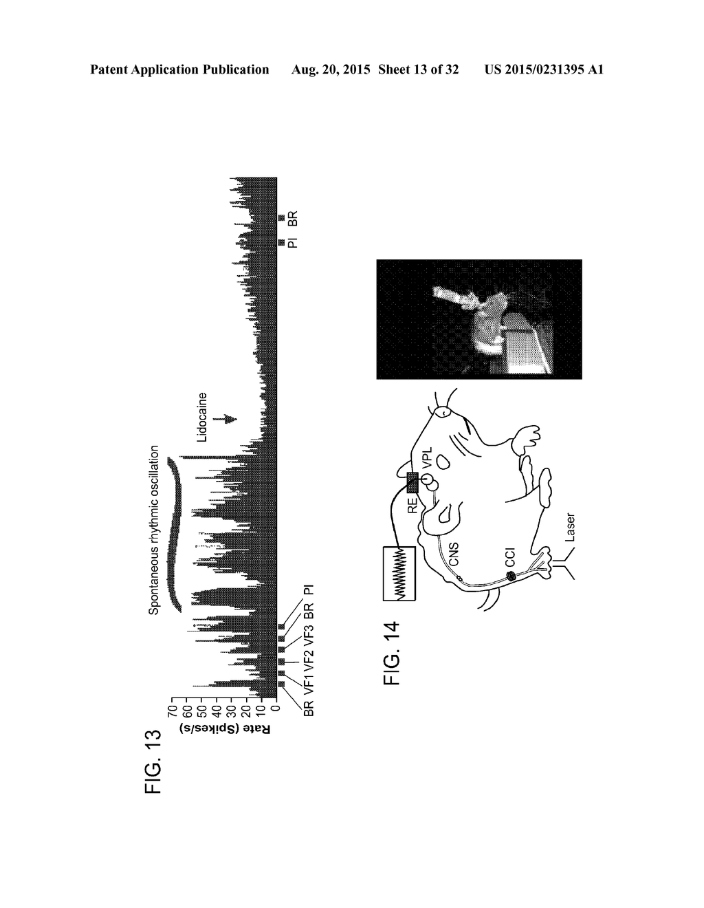 Pain Management - diagram, schematic, and image 14