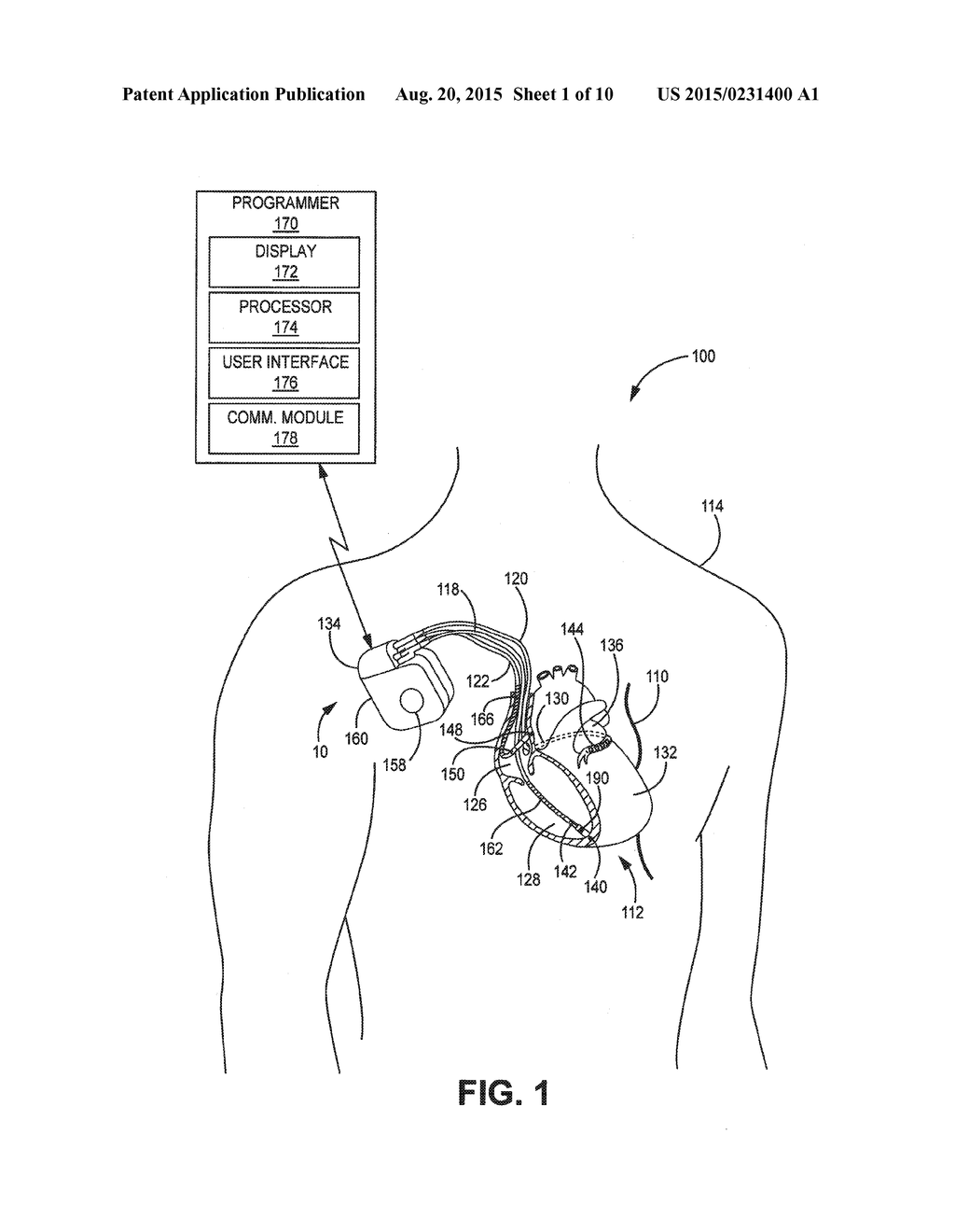 AUTOMATED PHRENIC NERVE STIMULATION AND PACING CAPTURE THRESHOLD TEST - diagram, schematic, and image 02