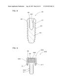 MAGNETIC FIELD GENERATOR FOR PROMOTING BONE GROWTH, AND IMPLANT DEVICE AND     DENTURE FOR IMPLANT PROTECTION USING THE SAME diagram and image